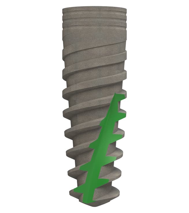 Lamina® Dental Implant – Internal Hex Connection thumbnail 2