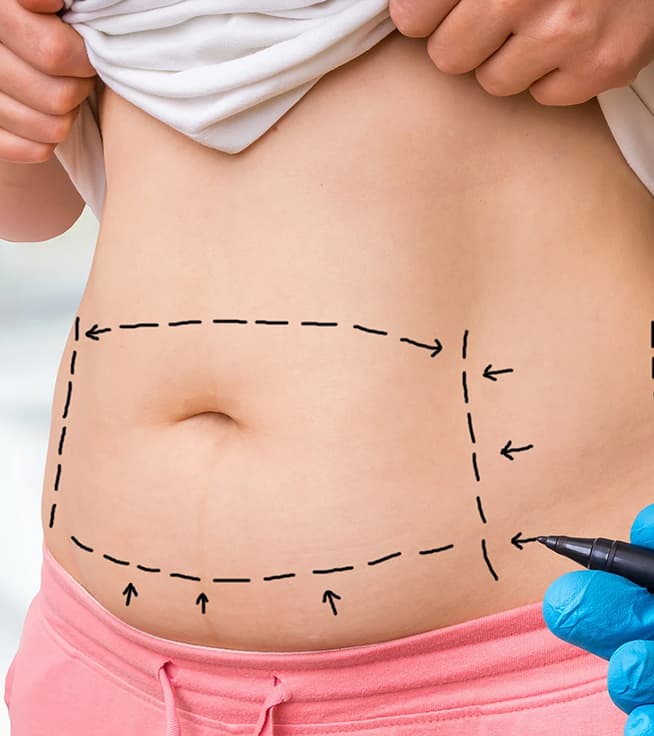 Understanding Different Types of Bariatric Surgery: A New Path to Sustainable Weight Loss