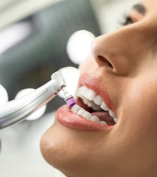 Oral Hygiene