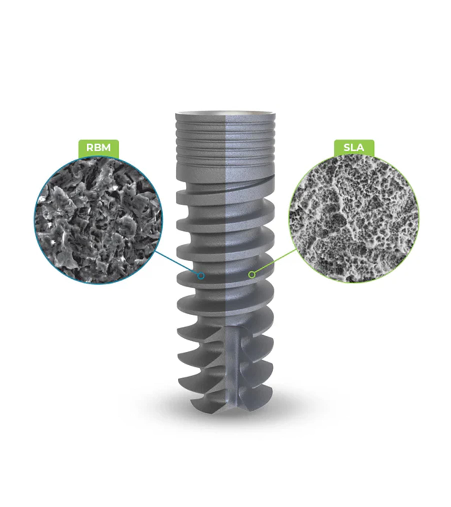Comparing Dental Implant Surfaces: SLA, SLActive, and RBM
