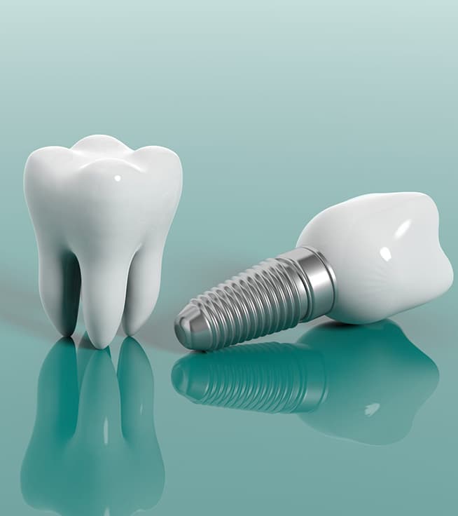 Benefits and Disadvantages of Dental Implants