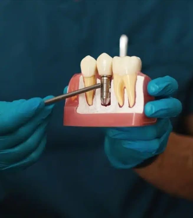 Dental Implants in Special Populations: Diabetes and Adolescents