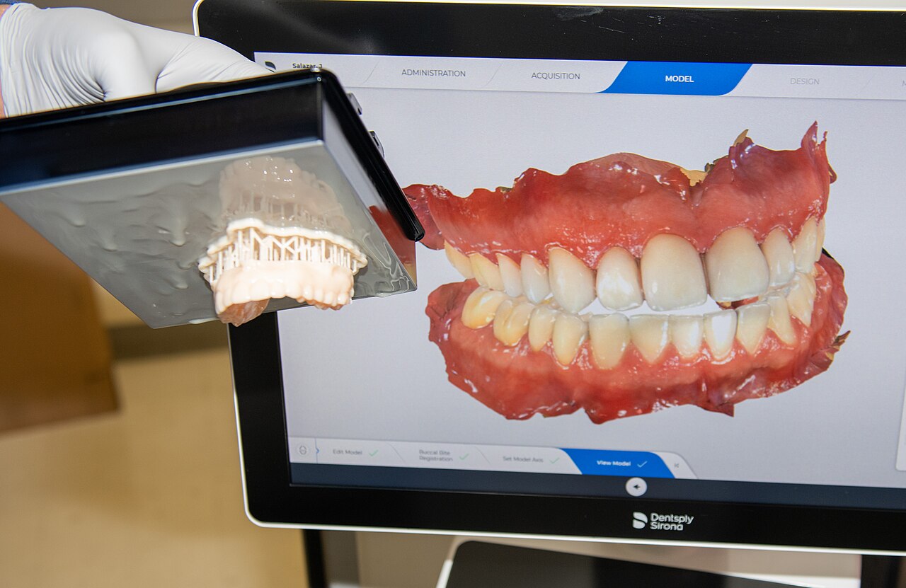 Digital CAD Staging and High-Precision 3D Dental Printing