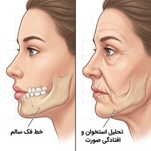 تاثیر تحلیل استخوان فک بر زیبایی و پیری زودرس چهره